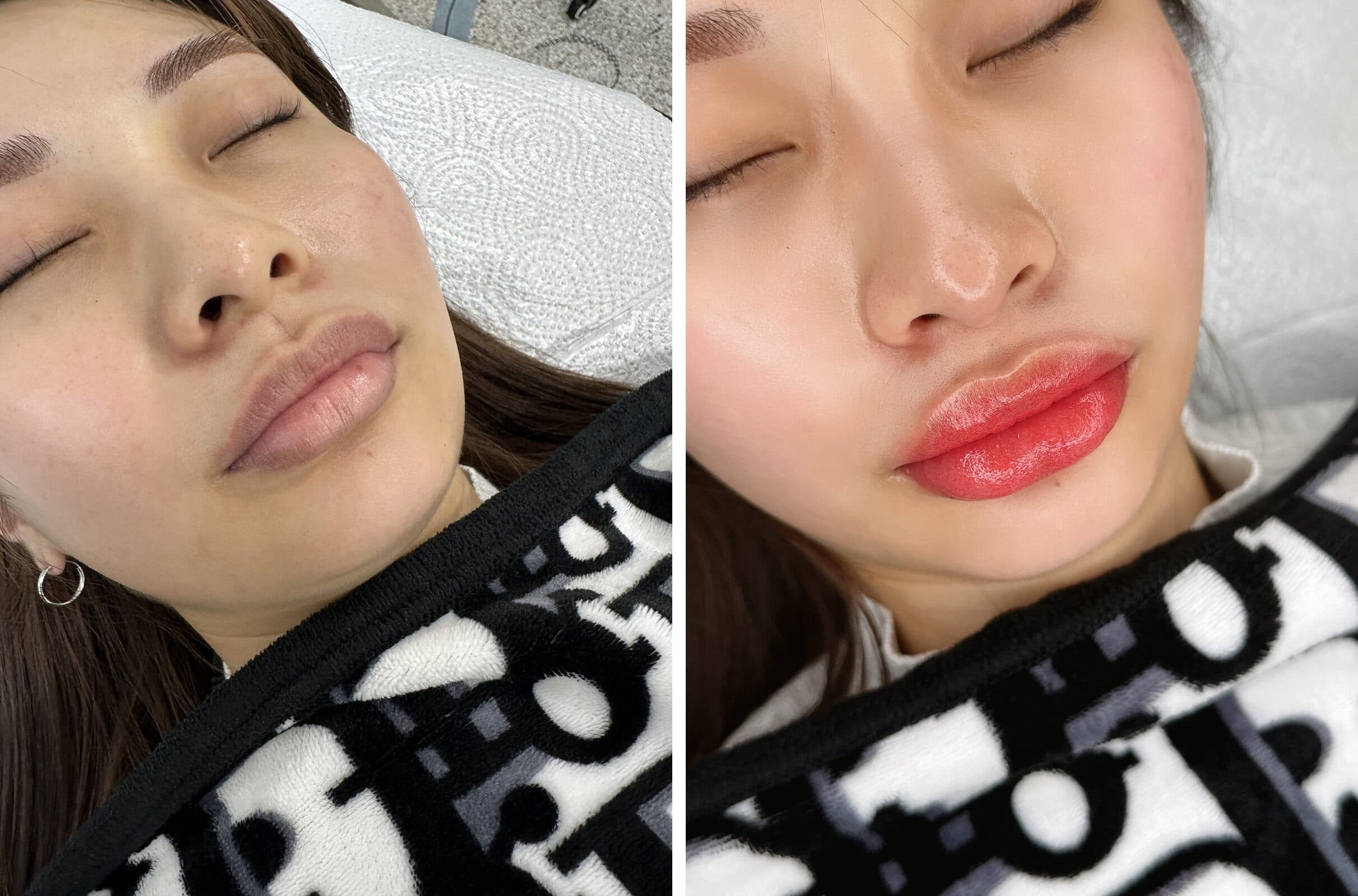 Lip blush before and after