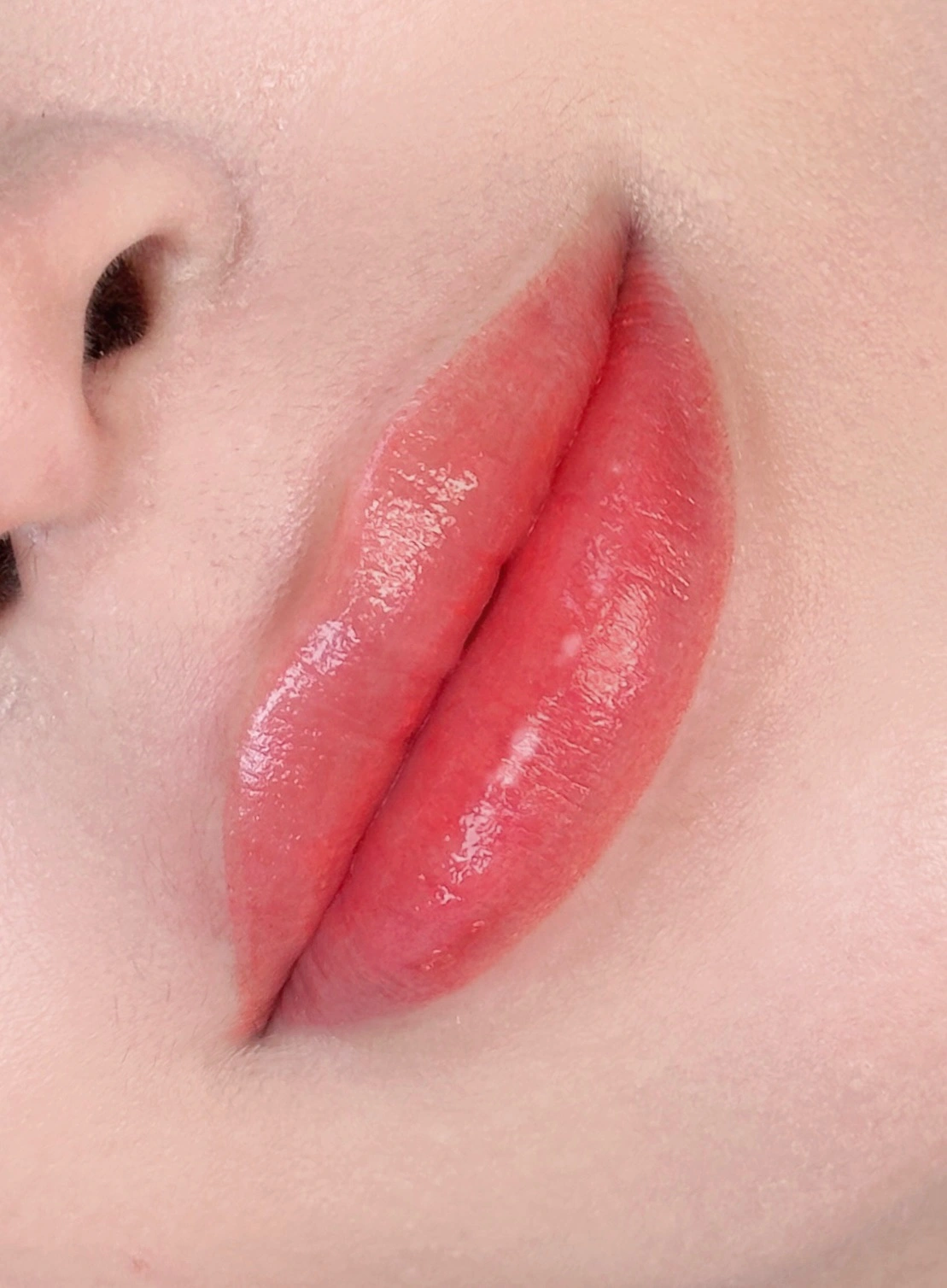 시술 결과 6
