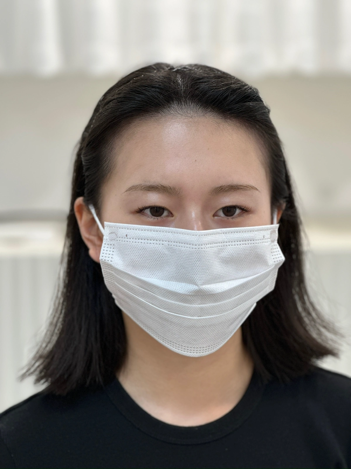자연 라인 · 사례 1 · 시술 전