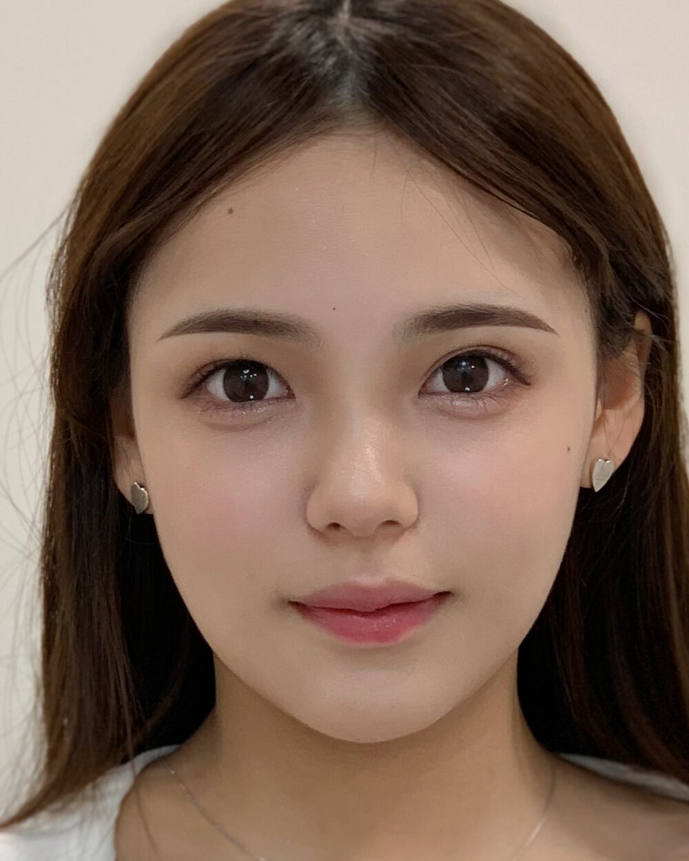 시술 결과 5